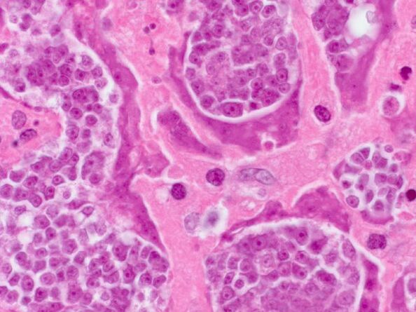 Pertsona batean parasitoen ikerketa