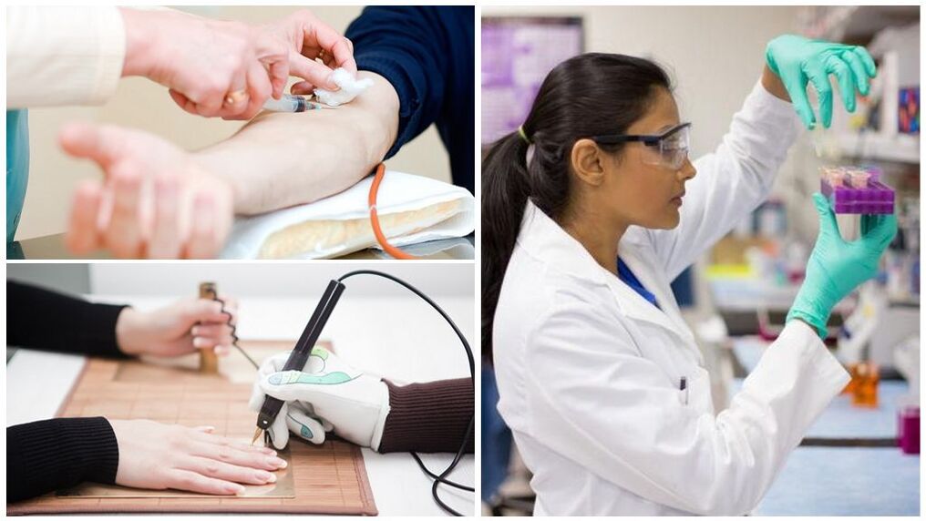 Diagnostiko metodoak parasitoak detektatzeko gorputzean