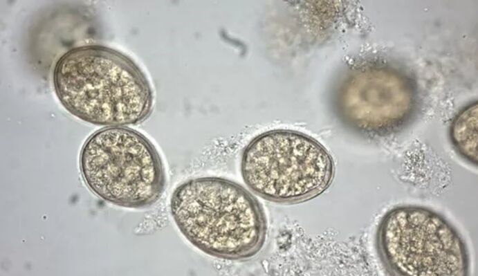 parasitoak mikroskopioan