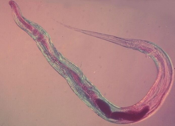 Mikroskopioan oxiuria