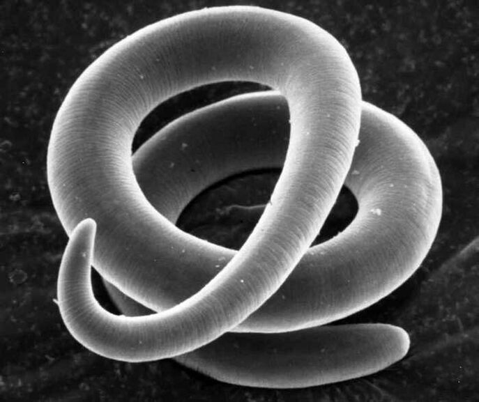 Trichinella mikroskopioan